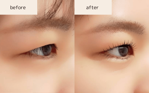 次世代まつげパーマ