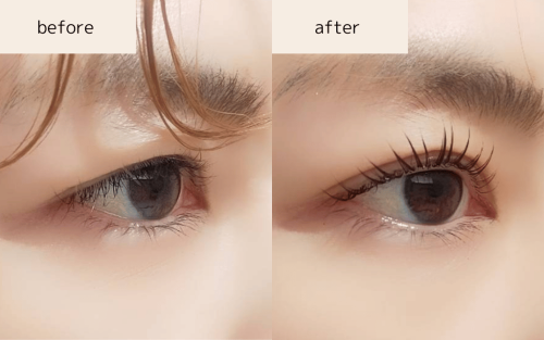 L3ラッシュリフト