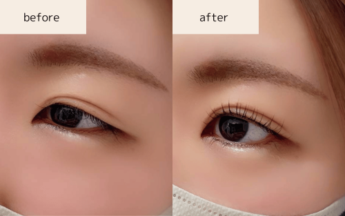 上下ケラチンラッシュリフト