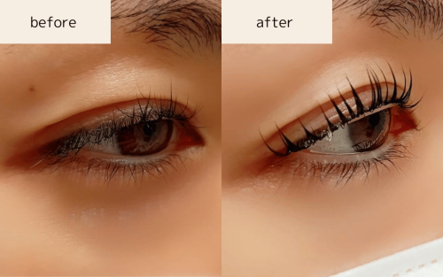 L3ラッシュリフト