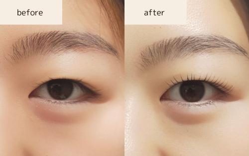 次世代まつげパーマ